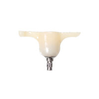 8700093 GCL Internal Hex Conical (3.5), (4.0), Maxillary Primary Molar A, J, EF10121785